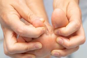 How Athlete’s Foot Spreads and Why It Matters
